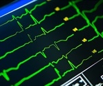 Free online Heart Age Test reveals likelihood of having a heart attack