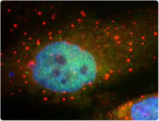P-bodies in HeLa cells in culture. P-bodies are shown based on immunostaining for the Rck protein (red). Image Credit: John Bloom and Roy Parker