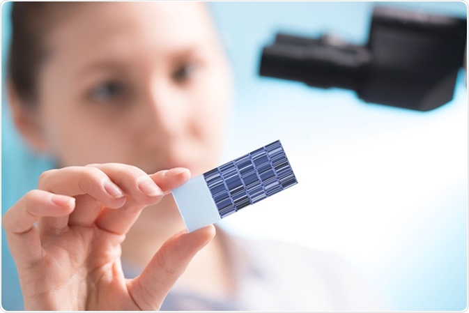 Chromatogram sequencing on slide. Image Credit: science photo / Shutterstock