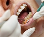 Hard Tissue Lasers in Dentistry
