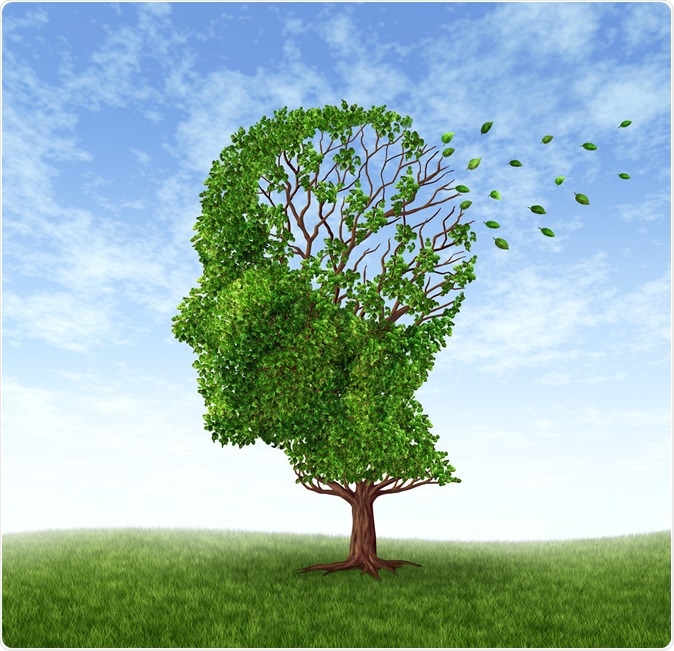Alzheimer’s diagnosis might become simpler with new brain imaging method​. Image Credit: Lightspring / Shutterstock