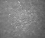 Scientists discover and characterize human skeletal stem cells