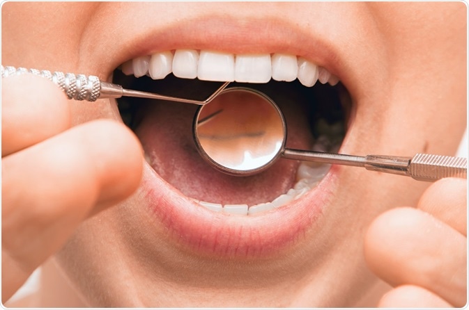Dentist examining teeth - a photo by Algirdas Gelazius