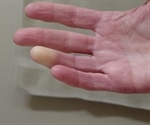 FDA guides Apricus Bio on RayVa's approvability for Raynaud's syndrome secondary to scleroderma