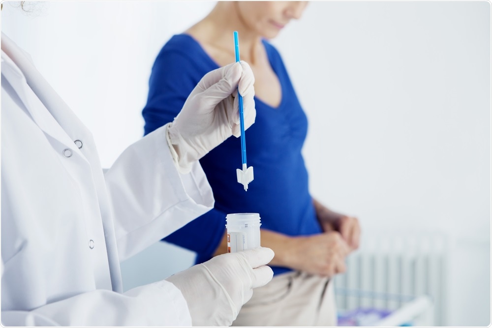 Photo of doctor holding smear sample and woman in background - test for cervical cancer - By Image Point Fr