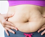 Excess belly fat may lead to a reduction in gray matter