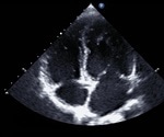 Cardiothoracic Imaging Techniques
