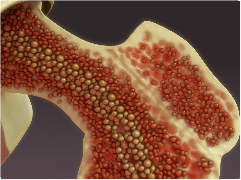 Blood vessels in bone - illustration by sciencepics