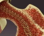Scientists discover new blood vessels in bone