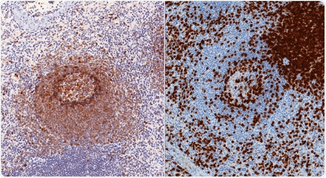 Spleen stained for CD79 (left) and CD3 (right) to show B and T cells - by vetpathologist