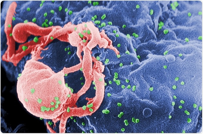 HIV SEM Image
