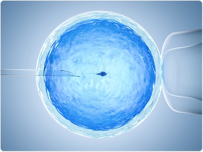 Microinjection of sperm into egg - IVF procedure - by Phonlamai Photo