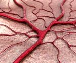 Blood vessels can now be created perfectly in a petri dish
