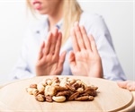 Half of all food allergy sufferers are not actually allergic