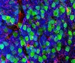 Unhealthy gut microbiome reduces brain synaptic pruning, impairs learning