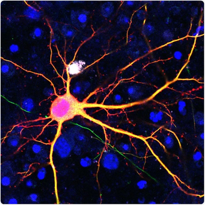 Neuron targeted using the SATI technology. Image Credit: Salk Institute
