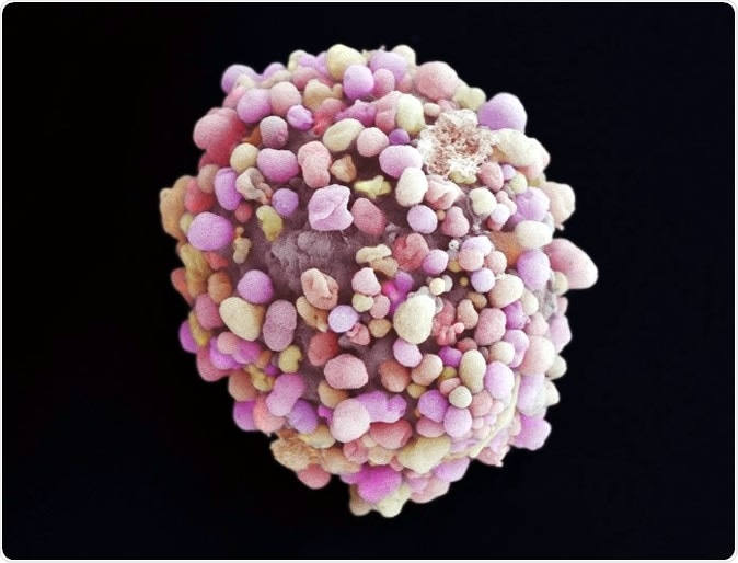 A new type of drug that blocks one of cancer’s key evolutionary escape routes from chemotherapy could be used to treat aggressive breast cancers, a new study has shown. © 2019 The Institute of Cancer Research
