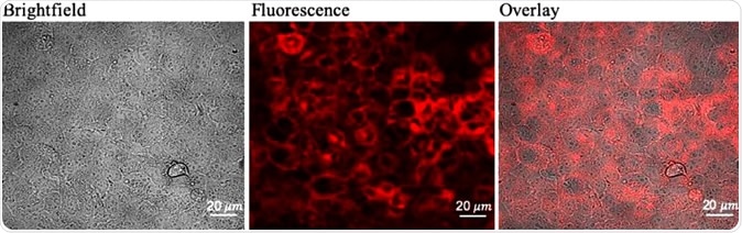 Determining optimal 5-ALA dose for maximum fluorescence and viability of glioma cells (a) Confocal images of PpIX fluorescence in Gli36 cells treated with 0.8 mM 5-ALA dose for 24 h. Brightfield image (left), fluorescence image (center), overlay image (right).