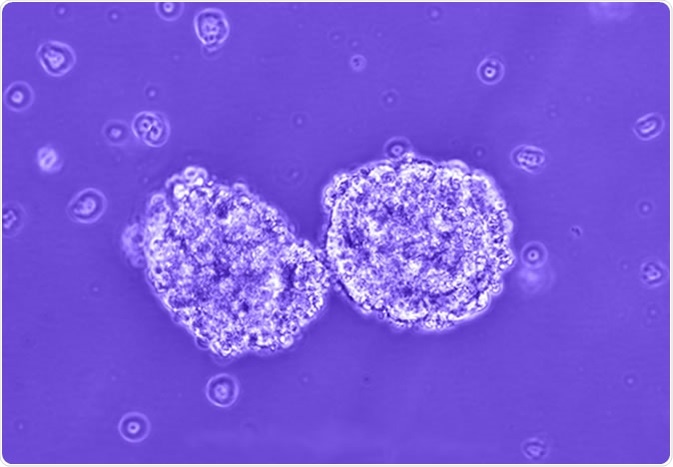Tumorspheres. Image Credit PLOS https://doi.org/10.1371/journal.pone.0063519
