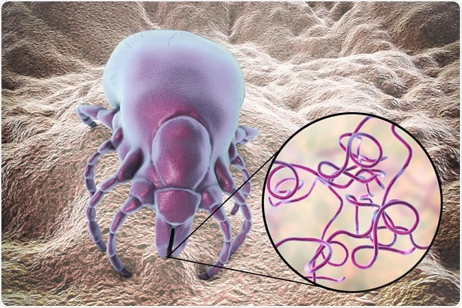 Lyme disease bacteria, Borrelia burgdorferi, transmitted by Ixodes tick, 3D illustration Credit: Kateryna Kon / Shutterstock