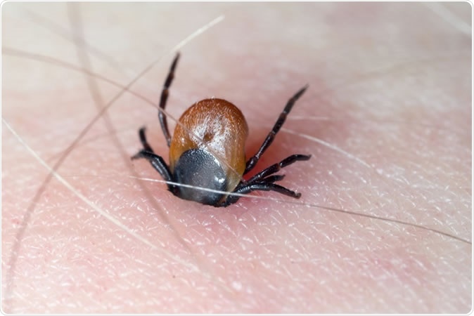 Tick with its chelicerae sticking in human skin. Image Credit: Tomasz Klejdysz / Shutterstock