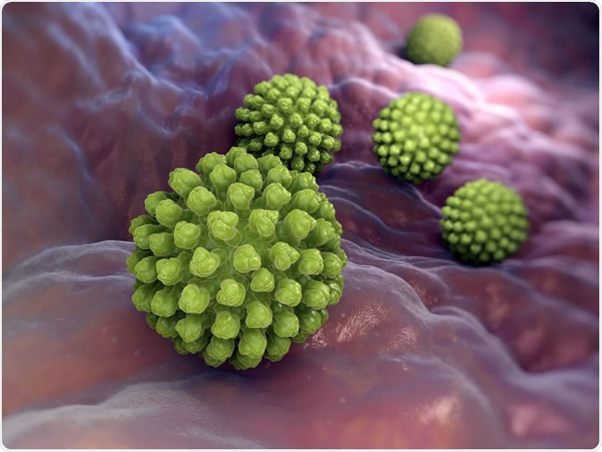 Rotavirus infection may play a role in the development of type 1 diabetes, according to a front matter article published October 10 in the open-access journal PLOS Pathogens by Leonard C. Harrison of the University of Melbourne in Australia, and colleagues. Image Credit: Tatiana Shepeleva / Shutterstock