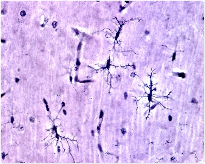 Microglia cells stained with Rio Hortega
