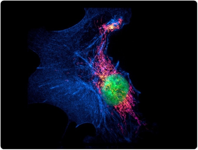 Endothelial cell visualized using SIM (a type of super-resolution microscopy)