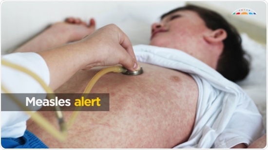 Australians traveling overseas urged to make sure their measles vaccinations are up to date