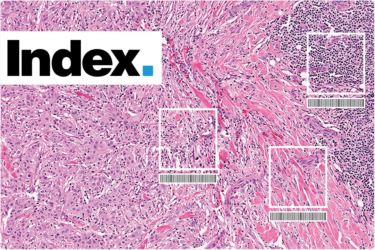 Index pathology images