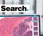 Driving Adoption of Digital Pathology with Image Search
