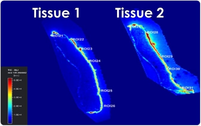 Sections of Labskin treated with Terbinafine without (Tissue 1) or with (Tissue 2) a penetration enhancer