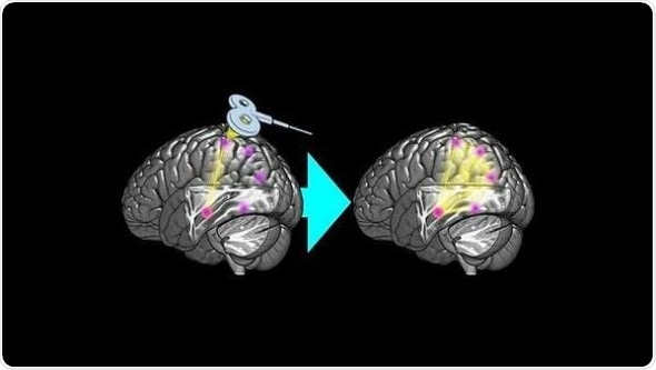 Brain stimulation increases functional connectivity of memory network
