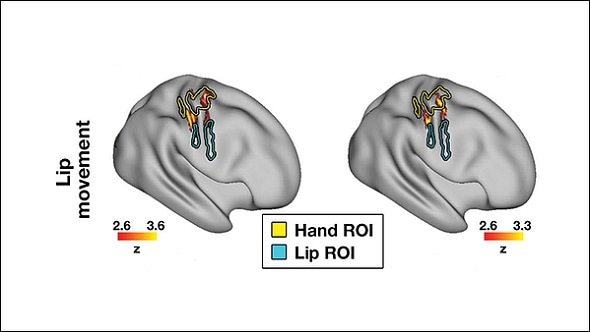 Location does not restrict brain remapping