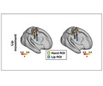 Location does not restrict brain remapping