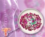 Vaginal fluid transplant could help treat recurring bacterial vaginosis