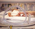 Risk of health conditions among adults who were born premature