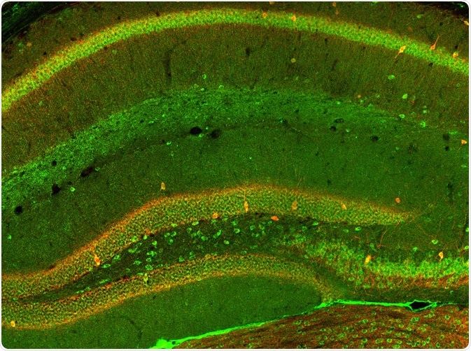 Confocal laser scanning microscope images of cells in the hippocampus of the mouse brain