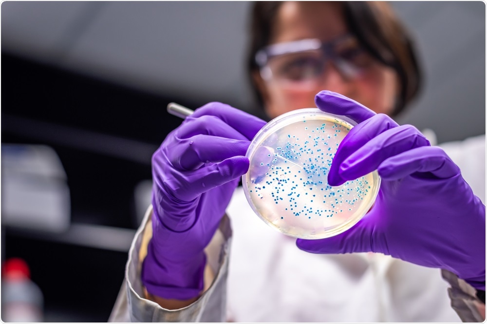 Researcher looking at microbes growing on petri dish