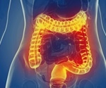 IBD far more common than expected, and will only increase in future