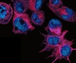 Novel, cost-effective method successfully identifies aggressive tumors