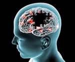 Alzheimer’s Disease | Definition, Causes, Diagnosis & Treatment