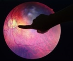 AI detects over 95 percent of diabetic retinopathy cases