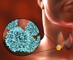 Low-risk thyroid cancer and stringent follow-up: who decides?