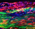 Study reports discovery of tendon stem cells