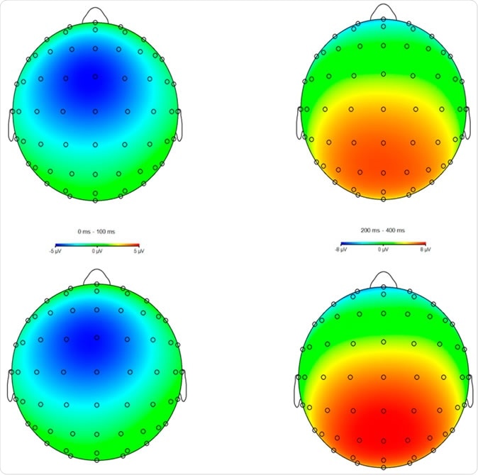 Scalp voltage maps for the error-minus-correct error-related negativity (ERN, left) and error positivity (Pe, right) as a function of group (control, top; meditation, bottom).