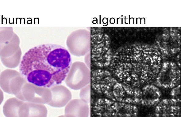 New AI-driven approach for single blood cell classification