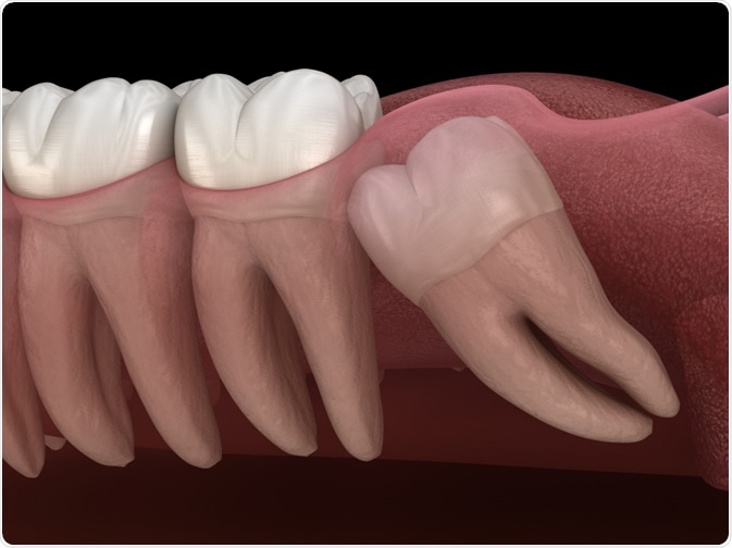 Normal tooth development.
