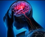 Frequent Headaches after a Traumatic Brain Injury