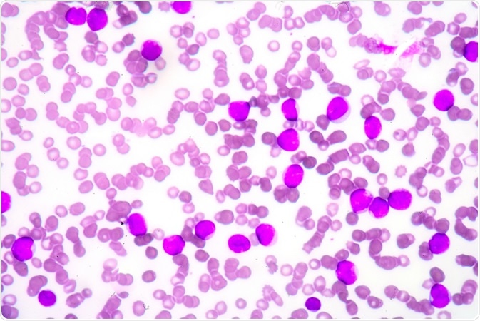 bone marrow blood cells
